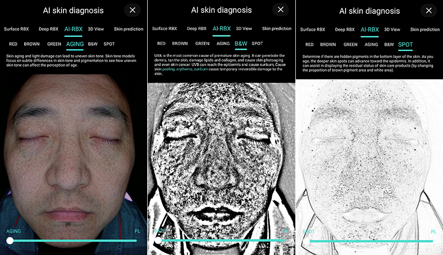 Pourquoi de plus en plus de centres esthétiques utilisent Skin Analyser ?