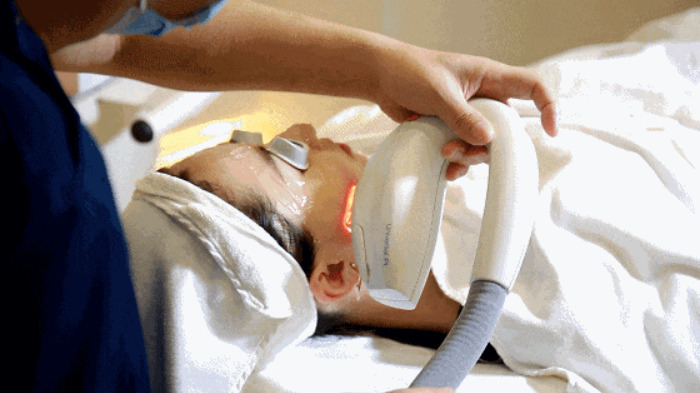 Est-ce suffisant pour faire un rajeunissement à la peau légère pulsée intense pendant seulement dix minutes?